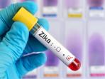 virus-zika_20160906_142549.jpg