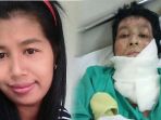wanita-ini-jadi-korban-kdrt-suami_20170310_202739.jpg