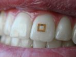 wearable-yang-dipasang-di-gigi_20180331_151308.jpg
