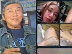 willy-dozan-buka-suara-soal-luka-lebam-di-tubuh-rinoa.jpg