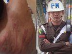 zf-korban-kekejaman-praka-rm.jpg