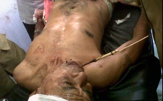 Perang di Adonara Terjadi Lagi, Gubernur Minta Solusi - Korban_Terkena_panah1.jpg