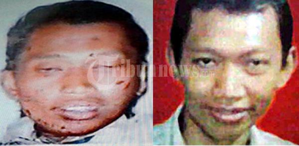 Diduga Pelaku Serangan Bom Bunuh Diri di Solo