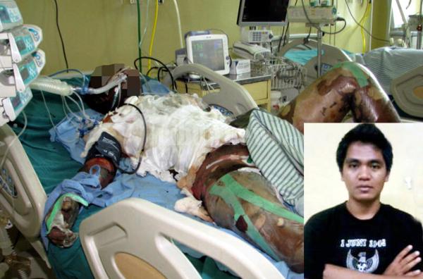 Sondang Hutagalung Terkulai Lemas Di RSCM