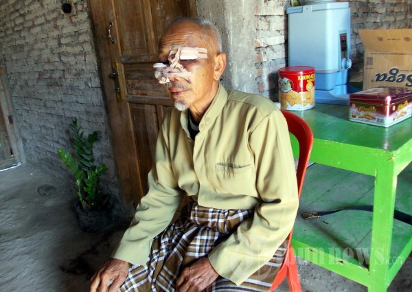 Densus 88 Pukul Wajah Wiji Siswosuwito
