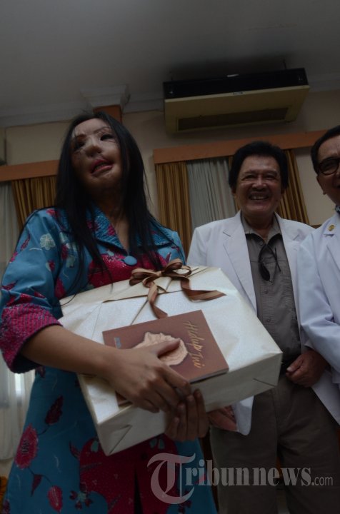 Lisa Pasien Face Off Dilepas RSU dr Soetomo