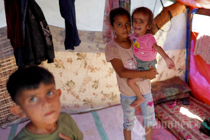 Anak Gaza Kekurangan Gizi di Tengah Serangan Israel