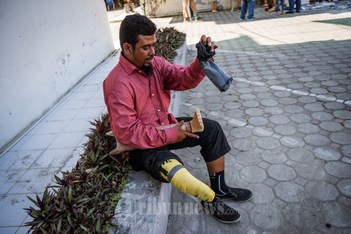 Bantuan Kaki Palsu Dinsos Aceh