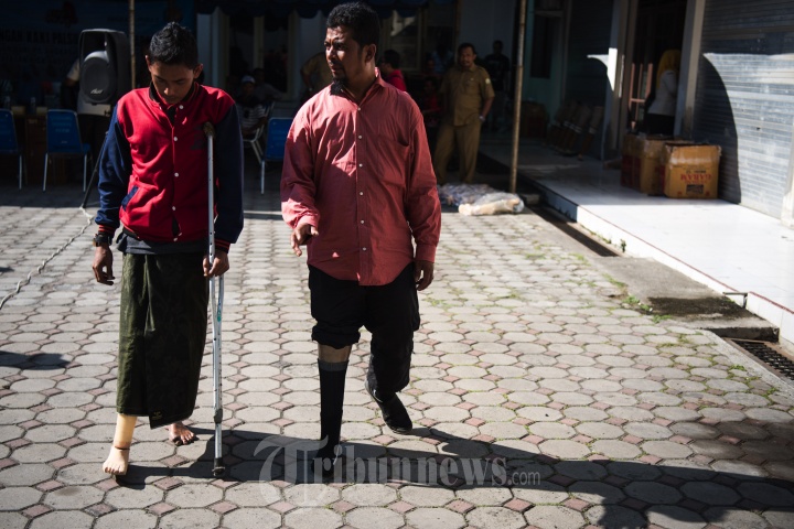 Bantuan Kaki Palsu Dinsos Aceh