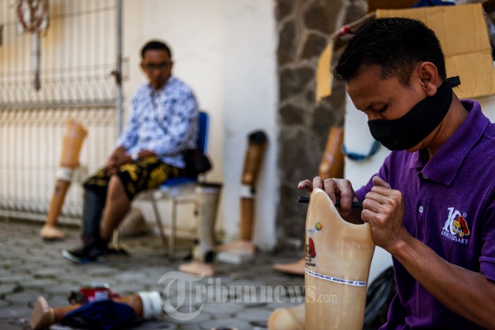 Bantuan Kaki Palsu Dinsos Aceh