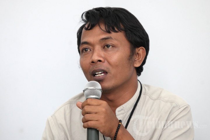 Bayi Kembar Siam Asal Subang di RS Hasan Sadikin