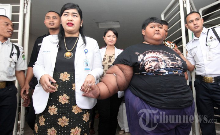 Bocah Obesitas Asal Karawang Kembali Diperiksa Kesehatannya