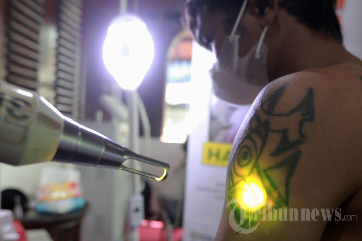 Hapus Tato Gratis di Bulan Ramadhan