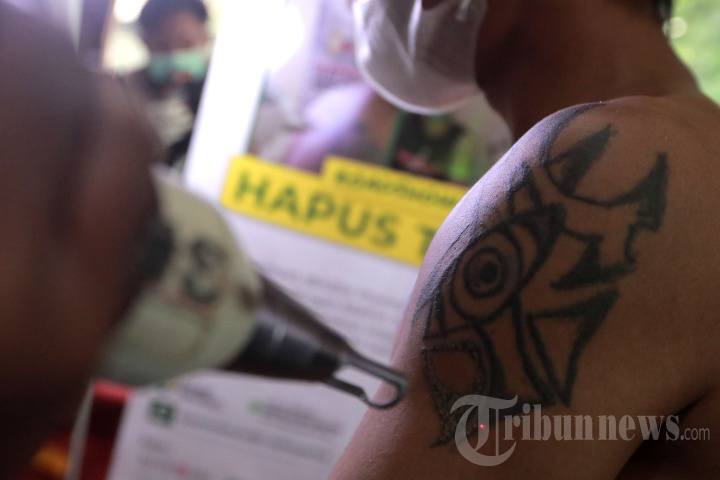 Hapus Tato Gratis di Bulan Ramadhan
