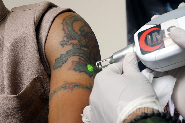 Hapus Tato Gratis Warga Marjinal