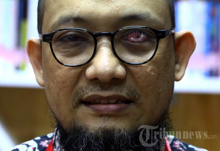 Hukum di Mata Novel Baswedan