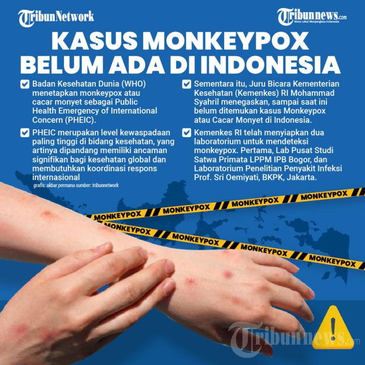 Jubir Kemenkes: Kasus Monkeypox Belum Ada di Indonesia