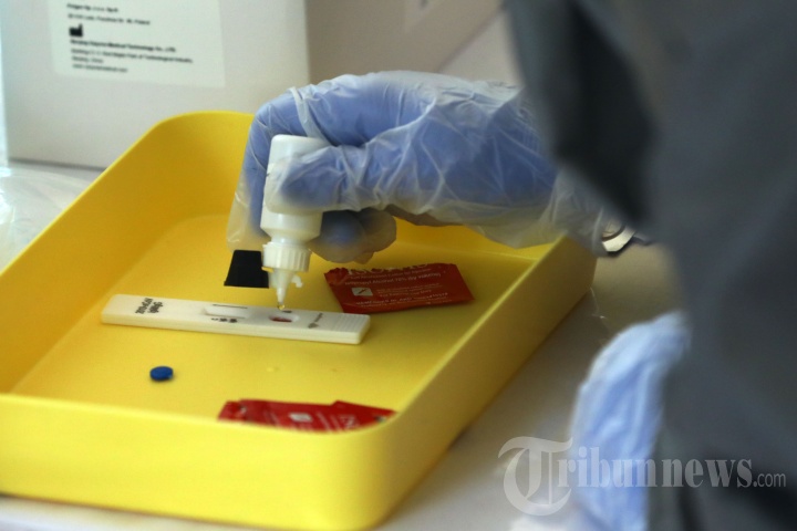 Kominfo Gelar Rapid Test Covid-19 untuk Jurnalis