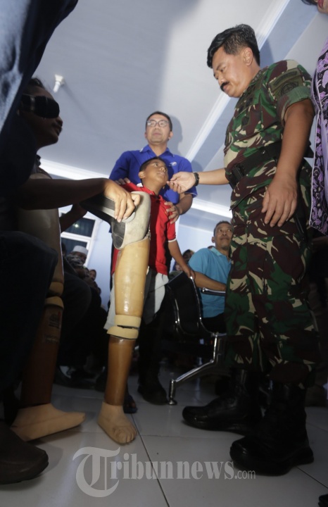 Panglima TNI Bantu Kaki Palsu Masyarakat