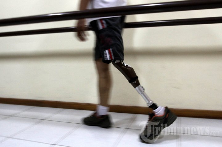 Teknologi Kaki Palsu Bagi Para Pahlawan