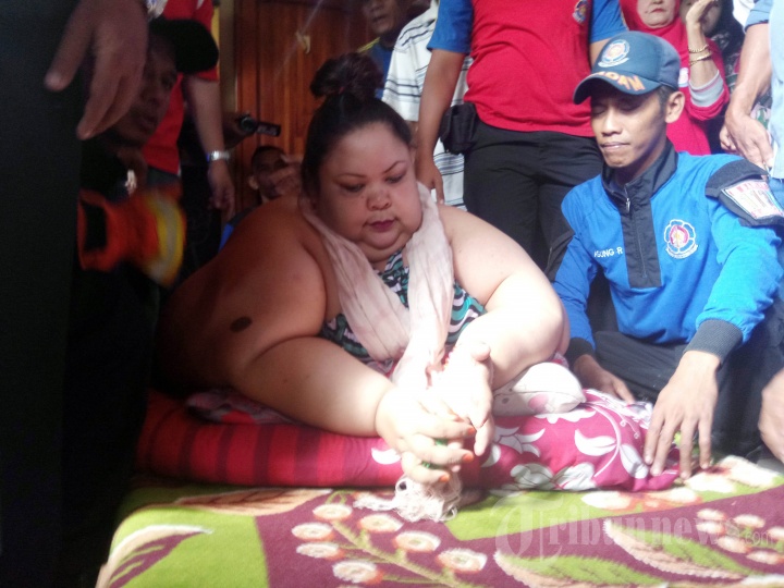 Titi Wati Penderita Obesitas