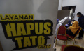 Layanan Hapus Tato Gratis di Balai Kota DKI Jakarta