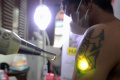Hapus Tato Gratis di Bulan Ramadhan