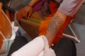 Ratusan Orang Ikuti Layanan Hapus Tato