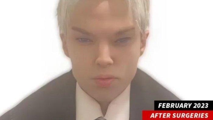 Aktor Kanada Saint Von Colucci Meninggal Pada Usia 22 Setelah 12 Operasi Agar Terlihat Seperti Jimin BTS