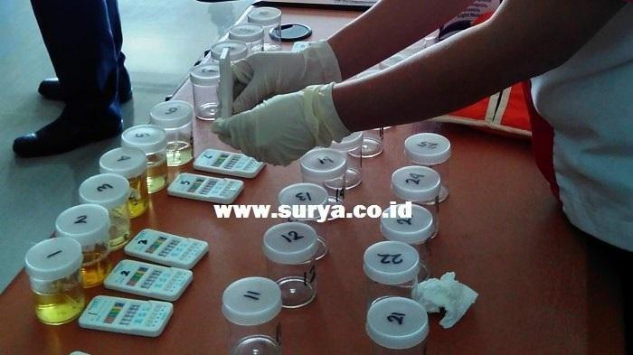 Ilustrasi tes narkoba