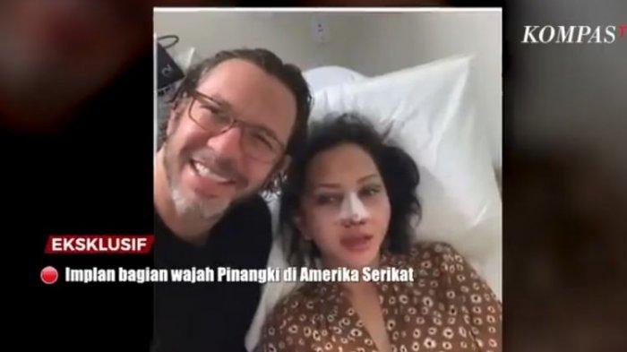 Jaksa Pinangki dikabarkan melakukanan operasi plastik di Amerika Serikat.(Tangkap layar AIMAN Kompas TV)
