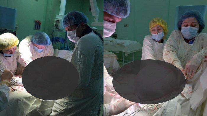 Proses pengangkatan tumor