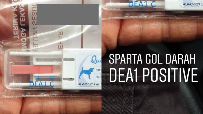 Sparta sempat membutuhkan donor darah pada Senin malam (28/10/2019)