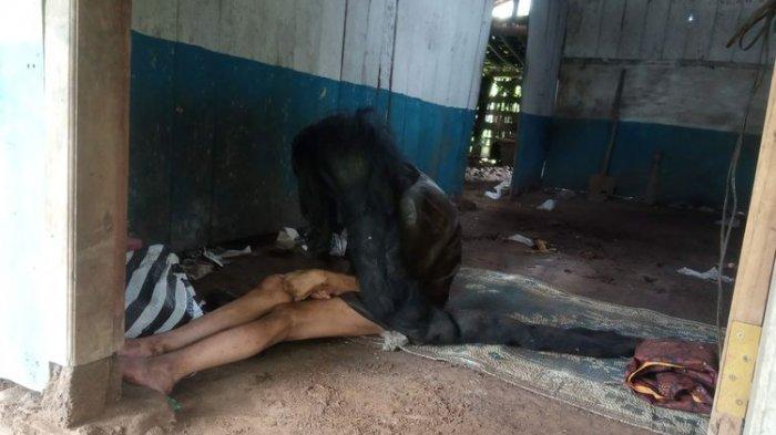 Sukiyah, 27 tahun berdiam di rumah hingga rambutnya menjadi sarang tikus
