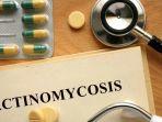 Aktinomikosis-adalah-infeksi-langka-yang-dapat-menyebar-ke-seluruh-jaringan-tubuh.jpg