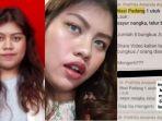 Borok Dokter Spesialis Bedah Prathita Amanda Dikuliti usai Diduga Jadi Pelaku Bully Aulia Risma