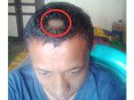 Kronologi Viral Orangtua Balas Gunting Rambut Guru Gara-gara Tak Terima Rambut Anaknya Dipangkas