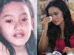 Nasib-Artis-Cantik-Dulu-Sering-Suntik-Putih-Demi-Kulit-Seksi-Kini-Menyesal-Idap-Penyakit-Berbahaya.jpg