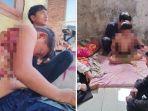 Nasib-Bocah-10-Tahun-Disiksa-Buyutnya-Disiram-Air-Panas-Sampi-Melepuh-Gara-gara-Minta-Nasi-Goreng.jpg