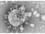 Penampakan-virus-corona-penyebab-SARS.jpg