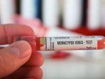 Tes-PCR-Monkeypox.jpg