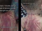 Video-Viral-Punggung-Bayi-Merah-Bekas-Kerokan-dari-Suster-Ibu-Bayi-Mau-Nangis-rasanya.jpg