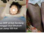 Viral-Siswa-SMP-Meninggal-Usai-Dihukum-100-Kali-Squat-Jump-Paha-Bengkak-hingga-Muncul-Lebam-Biru.jpg