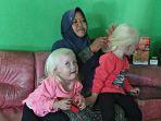 dua-orang-balita-albino-di-wonogiri-jawa-tengah.jpg