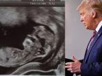 gambar-scan-bayi-yang-disebut-mirip-donald-trump-34.jpg