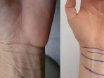 garis-pergelangan-tangan.jpg