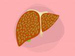 hepatitis-c-adalah-salah-satu-penyakit-yang-dapat-menyerang-hati.jpg
