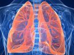 ilustrasi-asbestosis.jpg