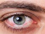 ilustrasi-mata-merah.jpg