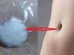 kapas-direndam-alkohol-pada-pusar.jpg